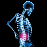 San Diego Low Back Pain Treatment