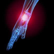 San Diego Wrist Pain and Hand Pain Treatment