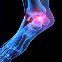 San Diego Chiropractor Foot Pain Treatment